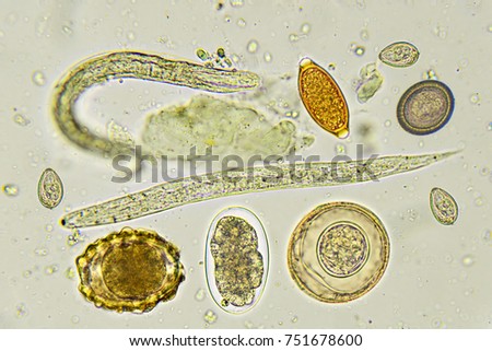 Mixed of helminthes in stool, analyze by microscope