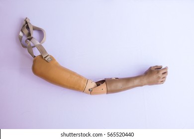Mobile Prosthetic Arm
