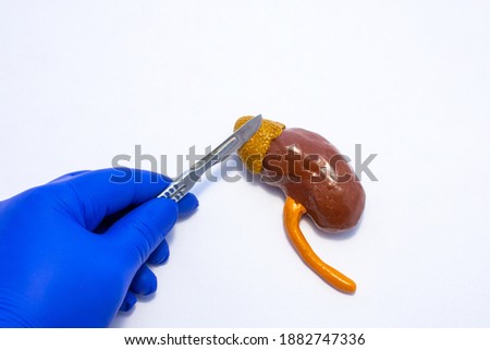 A model of a human kidney with an adrenal gland is on a table, above it is the surgeons hand with a scalpel. Adrenal gland surgery concept photo