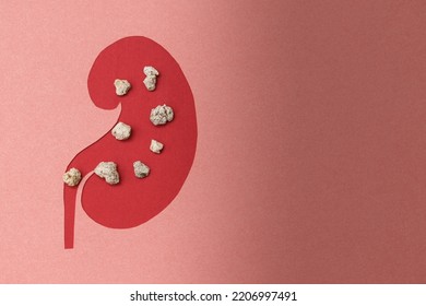 a model of a human kidney made on paper. the concept of timely kidney stones treatment.
