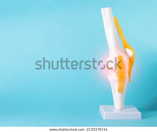 Model of a\
human knee joint on a blue background. Inflamed knee treatment,\
pain. Copy space for text,\
close-up