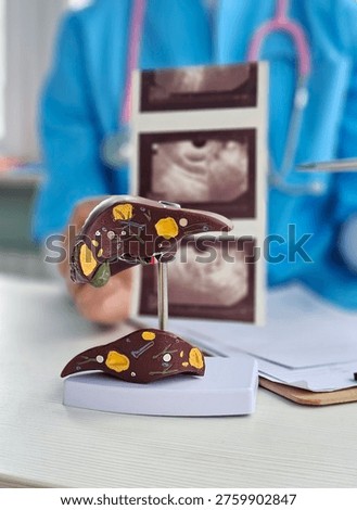 Model of human liver placed on a table in a medical office with ultrasound images in the background during a doctor's consultation