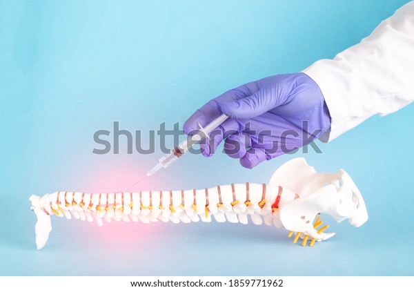 A model of the human spine on a blue background in\
which the doctor uses a syringe to make an injection blockade into\
a hernia of the spine. Treatment concept for radicular syndrome and\
back pain
