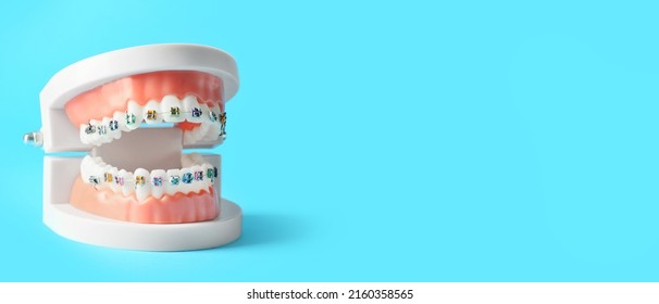 Model of jaw with braces on blue background with space for text - Shutterstock ID 2160358565