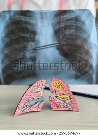 Model lungs displayed in front of a chest X-ray highlighting respiratory health and anatomy study