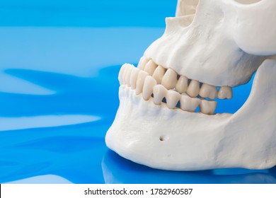 Model Of Prognathism. Jawbones With Maxillary And Mandibular Dentition And Protrusion Of Lower Jaw On Blue Background