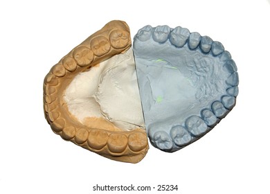 A model of someones teeth used for making a protective thingy