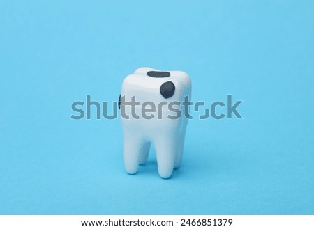 Model of a tooth affected by caries on blue background. Dental treatment
