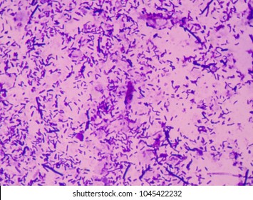 Moderate Bacteria Cells.