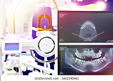 Modern Dental Digital 3D Tomograph