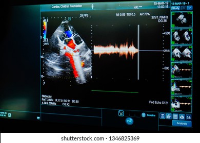 Modern medical equipment, ultrasound machine,Echocardiogramp.