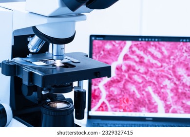 Modern microscope and human tissue section slide with computer monitor show glandular image.Medical patholology and cytology technology concept.Selective focus.
