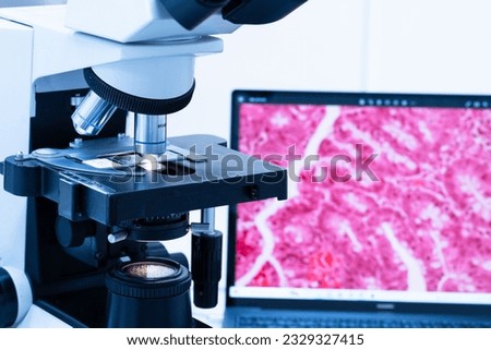 Modern microscope and human tissue section slide with computer monitor show glandular image.Medical patholology and cytology technology concept.Selective focus.