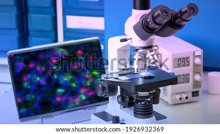 Modern microscope station with atibody-stained tissue sample image on the screen