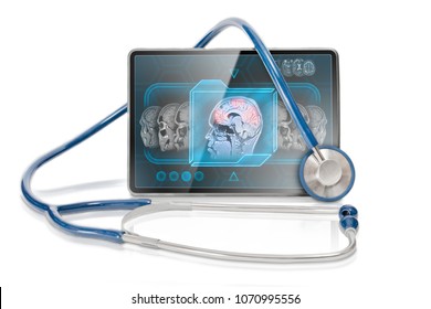 Modern Tablet Displaying Cerebral Activity On FMRI Scan