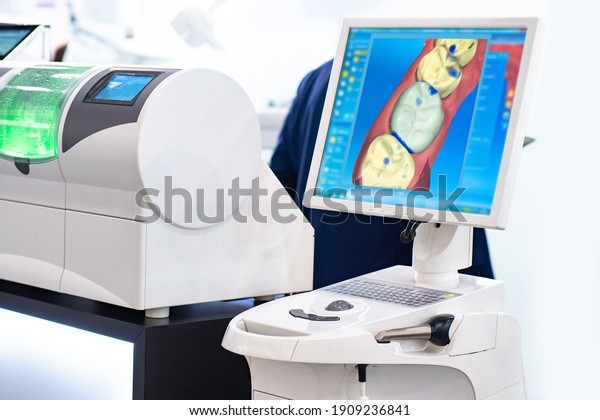 Modern technologies in dental industry. Digital\
dentistry concept. Digital scan of human teeth. Result is displayed\
on a blue screen. Equipment for dentistry. Prosthetics at dental\
industry