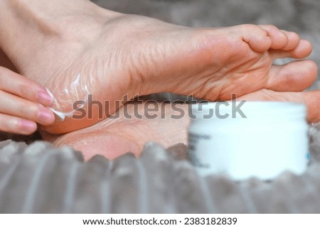 Moisturizing cream for dry, cracked skin. Foot care.