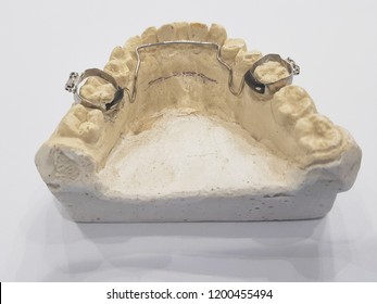 Molar Bands For Orthodontic Patients