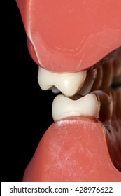 Molars Teeth Dental Occlusion