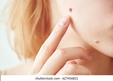 The mole on the girl's face closeup