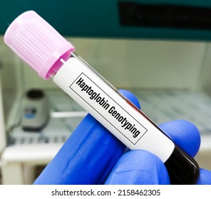 Molecular Biologist Hand Hold Blood Sample For Haptoglobin Genotype Test.