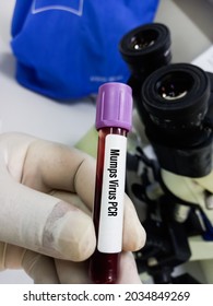 Molecular Biologist Hold Blood Sample For Mumps Virus PCR Test. Laboratory Background