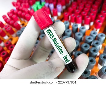 Molecular Biologist Hold Blood Sample For KRAS Mutation Test For Lung Cancer.