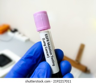 Molecular Biologist Holding Blood Sample For EGFR Mutation Test For The Diagnosis Of Lung Disease. Epidermal Growth Factor Receptor.