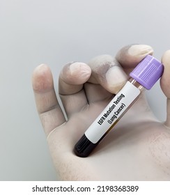 Molecular Biologist Holding Blood Sample For EGFR Mutation Test For The Diagnosis Of Lung Disease. Epidermal Growth Factor Receptor.