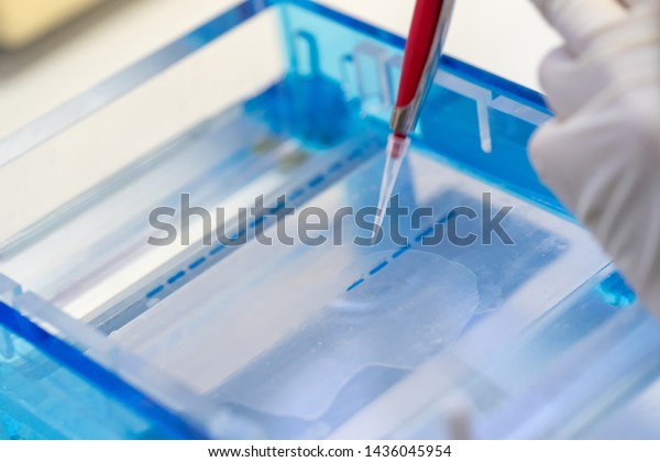 Molecular technique gel electrophoresis for\
DNA sample method decrypt the genetic code. biochemistry and\
clinical chemistry in\
laboratory.