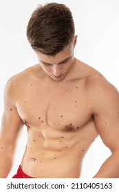 moles at upperbody of man who check his skin and control blemish spots dermatology to minimize risk of cancer and tumor 
