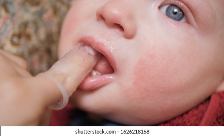 Mom Massages Baby Gums Using Toothbrush Massager Worn On Finger And Gum Gel. Teething Concept