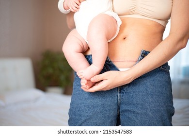 Mom's abdomen after cesarean section. Scar seam. A young mother holds the baby in her arms. Real motherhood. Lifestyle. High quality photo
