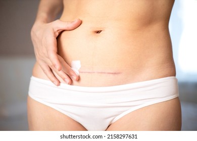 Mom's abdomen after cesarean section. Scar seam. bodypositive diversity Real motherhood. Lifestyle. High quality photo