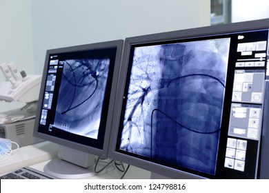 Monitor screen in radiology.
