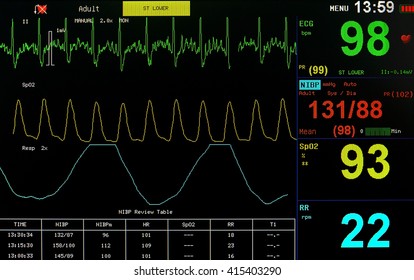 Monitoring Of Cardiac Function Unconscious Patient In ICU