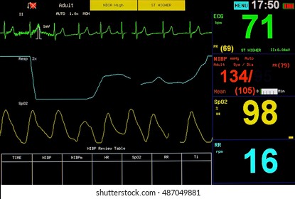 Monitoring Cardiac Function Unconscious Patient Icu Stock Photo ...