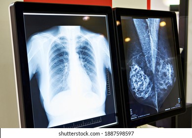 Monitors of x-ray images of human part
