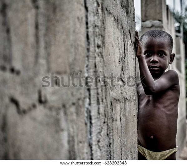 Monkey Village, LAGOS, NIGERIA. April, 2017:\
Street portrait of a young Nigerian boy suffering from\
malnutrition.\
Location: a rural area/village in Lagos, Nigeria\
called Monkey Village