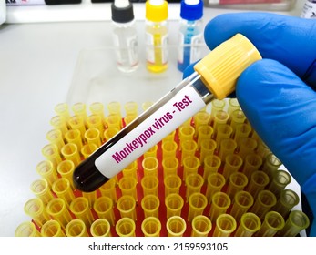 Monkeypox infection pandemic. Monkeypox infected blood sample at doctor's hand for laboratory test. Monkeypox is a rare disease that is caused by infection with virus.Sexual Health in uk, Africa, usa
