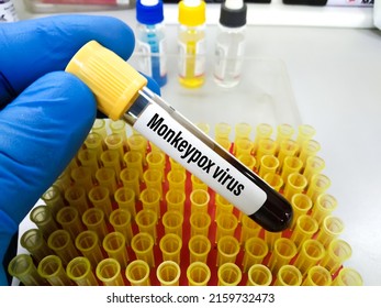 Monkeypox infection pandemic. Monkeypox infected blood sample at doctor's hand for laboratory test. Monkeypox is a rare disease that is caused by infection with virus.Sexual Health in uk, Africa, usa