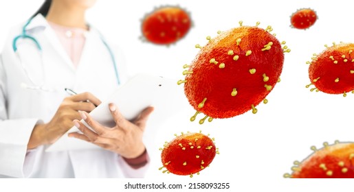 La pandemia de infección por varicela. La célula de varicela con médico en laboratorio lo confirma. La varicela es una enfermedad rara causada por la infección por virus. Salud sexual en el reino unido.