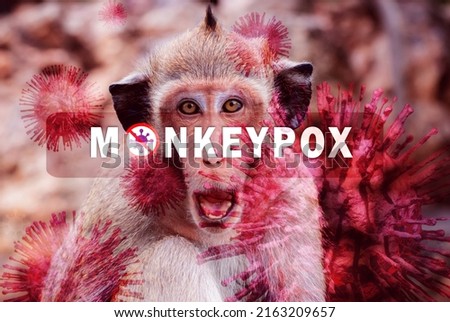 Monkeypox outbreak concept. Monkeypox is caused by monkeypox virus. Monkeypox is a viral zoonotic disease. Virus transmitted to humans from animals. Monkeys may harbor the virus and infect people.