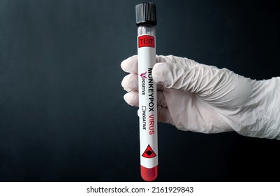 MONKEYPOX. Test Tube, Blood Sample For The MONKEY POX Test In The Doctor's Hand. Smallpox Virus, A Species Of The Genus Orthopoxvirus, Poxviridae. Danger Sign With Monkey. Virus, Epidemic, Disease.