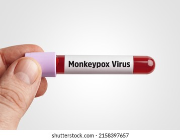 Konzept des Monkeypox-Virus (MPXV): Wissenschaftler, die das mit dem Monkeypox-Virus infizierte Blut im Reagenzglas auf weißem Hintergrund halten.