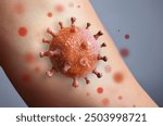 Monkeypox Virus on the skin, Microscopic View of the Monkeypox Virus. Close-Up Image of the Monkeypox Virus Structure, Skin Manifestation of Monkeypox, Dermatological viruses 