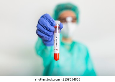 Monkeypox Virus Test. It Is Also Known As The Moneypox Virus, Is A Double-stranded DNA, Zoonotic Virus And A Species Of The Genus Orthopoxvirus In The Family Poxviridae