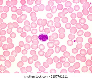 Monocyte Human Blood Smear Stock Photo 2157761611 | Shutterstock