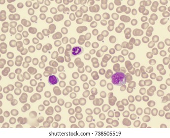 Monocyte Lymphocyte Neutrophil Stock Photo 738505519 | Shutterstock