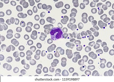 Monocyte (White Blood Cell)
